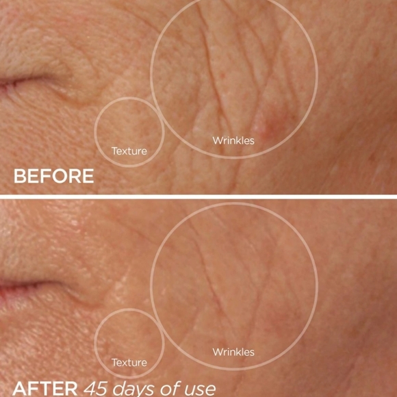 NIB BeautyBio R45 The Reversal Skincare Treatment - Picture 7 of 7